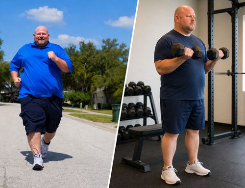 Why People With Obesity Shouldn’t Skip Weight Training